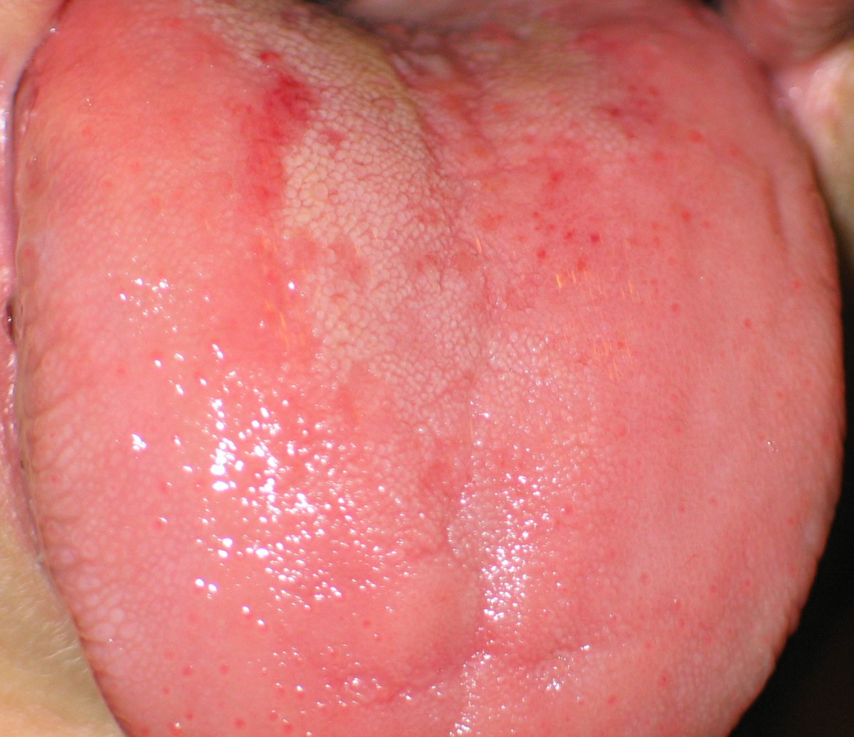 Healthy Tongue Photos