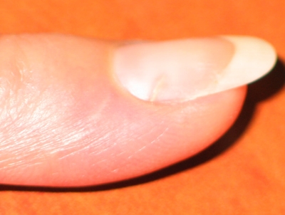 finger